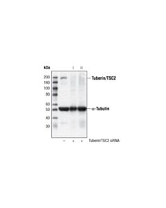 Cell Signaling Signalsilence Tuberin/Tsc2 Sirna I