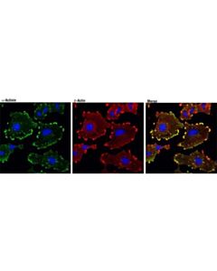 Cell Signaling Alpha-Actinin (D6f6) Xp Rabbit mAb