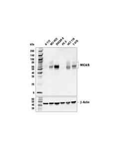 Cell Signaling Mica/B (E9n7g) Rabbit mAb