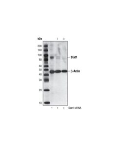 Cell Signaling Signalsilence Stat1 Sirna Ii