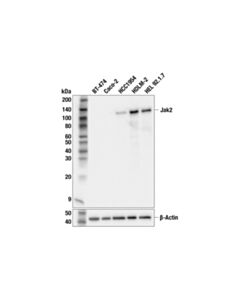 Cell Signaling Jak2 (F7S5R) Rabbit mAb; 20 µl