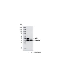 Cell Signaling Signalsilence P53 Sirna Ii