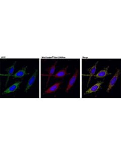 Cell Signaling Aco2 (D6d9) Xp Rabbit mAb