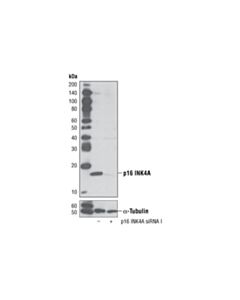 Cell Signaling Signalsilence P16 Ink4a Sirna I