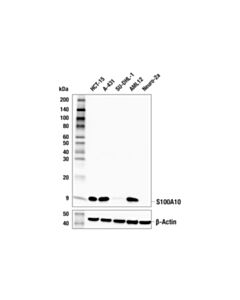 Cell Signaling S100a10 (E4h1q) Rabbit mAb