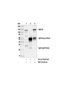 Cell Signaling Nat10 Antibody
