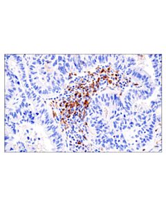 Cell Signaling Dnam-1/Cd226 (E8l9g) Xp Rabbit mAb