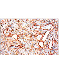 Cell Signaling Col1a1 (E3e1x) Mouse mAb