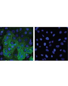 Cell Signaling Dpp4/Cd26 (D6d8k) Rabbit mAb