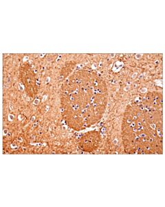 Cell Signaling Neurofilament-M (E7L2T) Rabbit mAb 20 uL