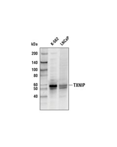 Cell Signaling Txnip (D5f3e) Rabbit mAb (Biotinylated)