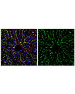 Cell Signaling Lyve-1 (E3l3v) Rabbit mAb