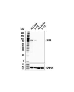 Cell Signaling SIK1 (F5D8F) Rabbit mAb 20 uL