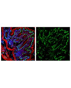 Cell Signaling Fus/Tls (E3o8i) Rabbit mAb