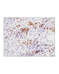 Cell Signaling Gitr (D9i9d) Rabbit mAb (Ihc Preferred)