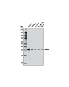 Cell Signaling Notch Activated Targets Antibody Sampler Kit
