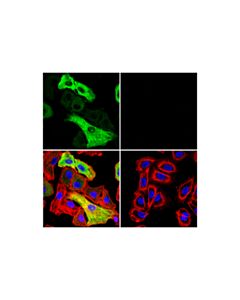 Cell Signaling Sars-Cov-1/2 Nucleocapsid Protein (1c7c7) Mouse mAb