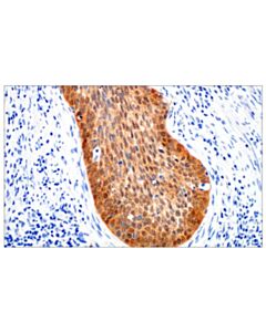 Cell Signaling P16 Ink4a (Bc42) Mouse mAb