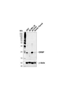Cell Signaling Cirbp (D1m8d) Rabbit mAb