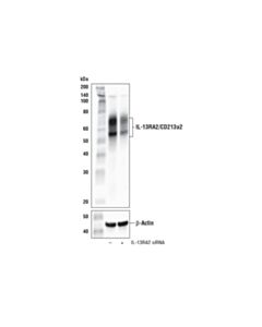 Cell Signaling Il-13ra2/Cd213a2 (E7u7b) Rabbit mAb (BSA And Azide Free)