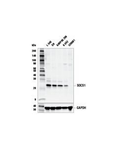 Cell Signaling SOCS1 (E4K7Q) Rabbit mAb 20 uL