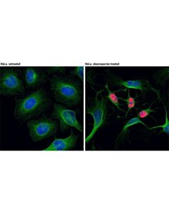 Cell Signaling Cleaved Parp (Asp214) (D64e10) Xp Rabbit mAb (Alexa Fluor 555 Conjugate)