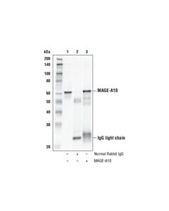 Cell Signaling Mage-A10 Antibody