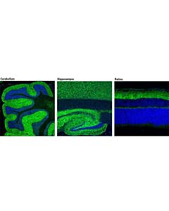 Cell Signaling Bassoon (D63b6) Rabbit mAb