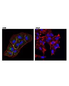 Cell Signaling Cavin-1 (D1p6w) Rabbit mAb