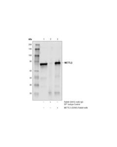 Cell Signaling N6-Ma Methyltransferase Antibody Sampler Kit