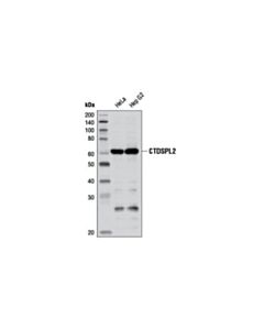 Cell Signaling Ctdspl2 (D79g11) Rabbit mAb