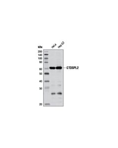 Cell Signaling CTDSPL2 (D79G11) Rabbit mAb 20 uL