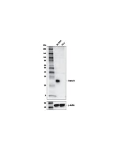 Cell Signaling Twist1 (E7e2g) Rabbit mAb