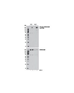 Cell Signaling Phospho-Her2/Erbb2 (Tyr1196) (D66b7) Rabbit mAb