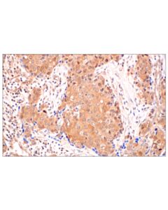 Cell Signaling Gasdermin D (E5o4n) Rabbit mAb