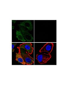 Cell Signaling Gasdermin D (E5O4N) Rabbit mAb 20 uL