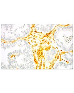 Cell Signaling Signalstain Radiant Yellow Peroxidase Substrate Kit