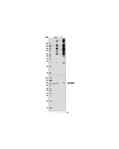 Cell Signaling Phospho-Atm/Atr Substrate Motif [(PS/Pt) Qg] Multimab Rabbit mAb Mix