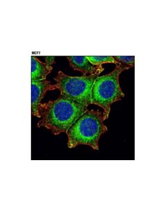 Cell Signaling Rab8a (D22d8) Xp Rabbit mAb