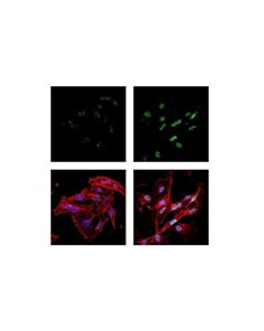 Cell Signaling Pml (E6s9l) Rabbit mAb