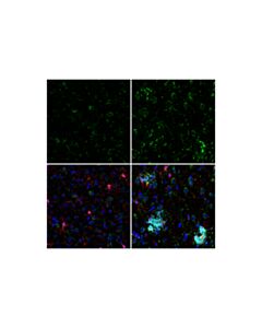 Cell Signaling Cathepsin D (E179) Antibody