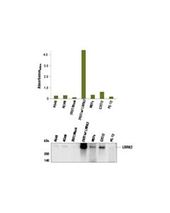 Cell Signaling Pathscan ® Total Lrrk2 Sandwich ELISA Kit