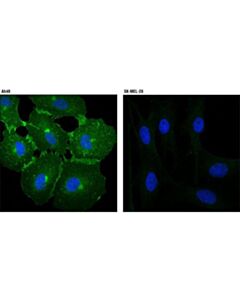 Cell Signaling Epha2 (D4a2) Xp Rabbit mAb