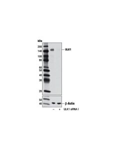 Cell Signaling Signalsilence Ulk1 Sirna I