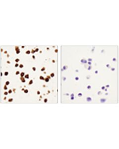 Cell Signaling F4/80 (D2s9r) Xp Rabbit mAb
