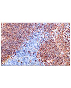 Cell Signaling Cd20 (E3n7o) Xp Rabbit mAb