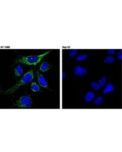 Cell Signaling Tspo (D1n7z) Rabbit mAb
