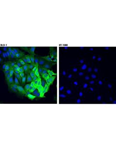 Cell Signaling Ass1 (D4o4b) Xp Rabbit mAb