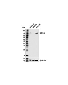 Cell Signaling Gm130 (E9z6s) Rabbit mAb