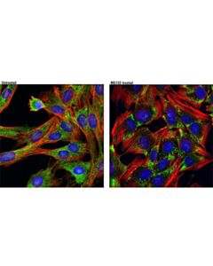 Cell Signaling Fxr2 (D85d6) Rabbit mAb